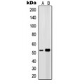 LifeSab™ EP4 Rabbit pAb (50 µl)