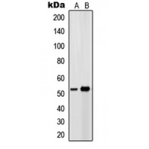 LifeSab™ EP4 Rabbit pAb (50 µl)