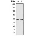 LifeSab™ GLUT2 Rabbit pAb (50 µl)