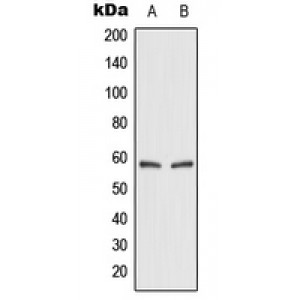 LifeSab™ GLUT2 Rabbit pAb (50 µl)