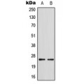 LifeSab™ SRD5A1 Rabbit pAb (50 µl)