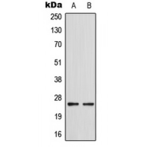 LifeSab™ SRD5A1 Rabbit pAb (50 µl)