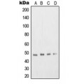 LifeSab™ DP2 Rabbit pAb (50 µl)