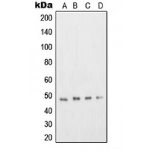 LifeSab™ DP2 Rabbit pAb (50 µl)