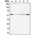 LifeSab™ p53 Rabbit pAb (50 µl)