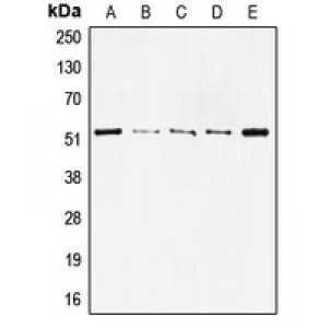 LifeSab™ p53 Rabbit pAb (50 µl)