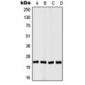 LifeSab™ VHL Rabbit pAb (50 µl)