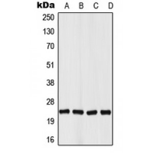 LifeSab™ VHL Rabbit pAb (50 µl)