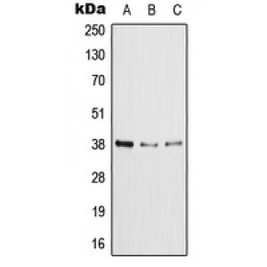 LifeSab™ XRCC4 Rabbit pAb (50 µl)