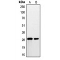 LifeSab™ PSCA Rabbit pAb (50 µl)