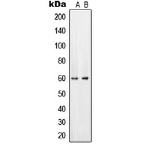 LifeSab™ PAHT Rabbit pAb (50 µl)