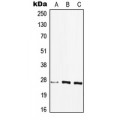 LifeSab™ HLA-DQB2 Rabbit pAb (50 µl)