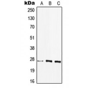 LifeSab™ HLA-DQB2 Rabbit pAb (50 µl)