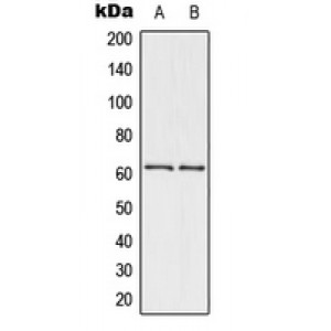 LifeSab™ CHK2 (pT432) Rabbit pAb (50 µl)