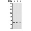 LifeSab™ RAB39A Rabbit pAb (50 µl)