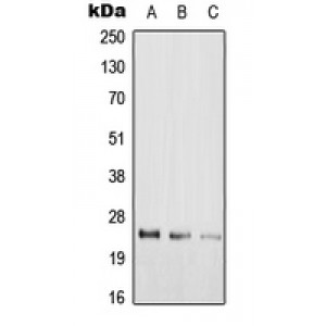 LifeSab™ RAB39A Rabbit pAb (50 µl)