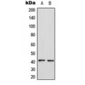 LifeSab™ CCR4 Rabbit pAb (50 µl)