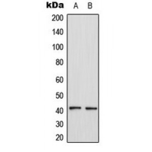 LifeSab™ CCR4 Rabbit pAb (50 µl)