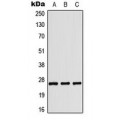 LifeSab™ Tumstatin Rabbit pAb (50 µl)