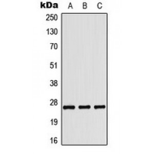 LifeSab™ Tumstatin Rabbit pAb (50 µl)