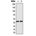 LifeSab™ p53 (pS33) Rabbit pAb (50 µl)