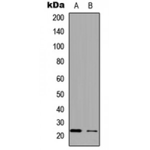 LifeSab™ APOBEC3C Rabbit pAb (50 µl)