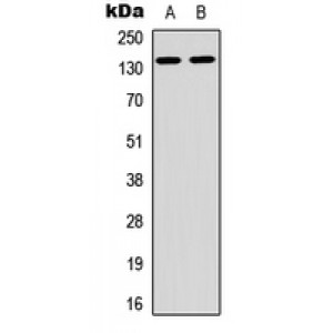 LifeSab™ ARHGAP20 Rabbit pAb (50 µl)