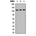 LifeSab™ CD41 LC 1 Rabbit pAb (50 µl)