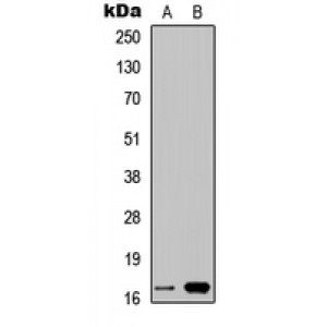 LifeSab™ Cystatin 9L1 Rabbit pAb (50 µl)