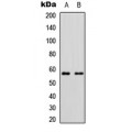 LifeSab™ CYP11B2 Rabbit pAb (50 µl)