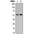 LifeSab™ Factor IX HC Rabbit pAb (50 µl)