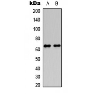 LifeSab™ HABP2 HC Rabbit pAb (50 µl)