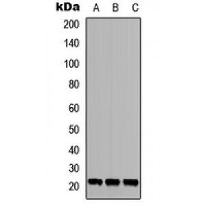 LifeSab™ TGIF2LY Rabbit pAb (50 µl)