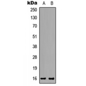 LifeSab™ TNP2 Rabbit pAb (50 µl)