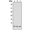 LifeSab™ Apolipoprotein C1 Rabbit pAb (50 µl)