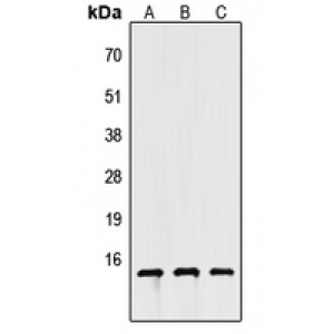 LifeSab™ Apolipoprotein C4 Rabbit pAb (50 µl)