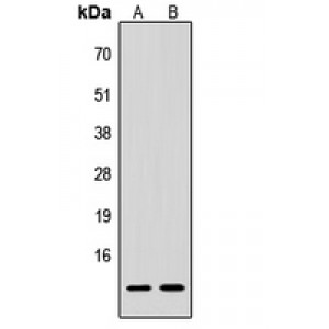 LifeSab™ Procalcitonin Rabbit pAb (50 µl)