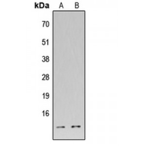 LifeSab™ DFF45 Rabbit pAb (50 µl)