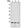 LifeSab™ FABP4 Rabbit pAb (50 µl)