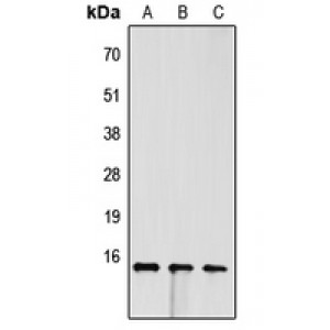 LifeSab™ FABP4 Rabbit pAb (50 µl)