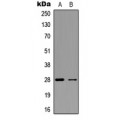 LifeSab™ FGF23 Rabbit pAb (50 µl)