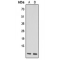 LifeSab™ NDUFA1 Rabbit pAb (50 µl)