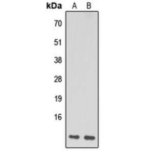 LifeSab™ NDUFA1 Rabbit pAb (50 µl)