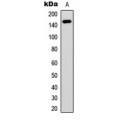 LifeSab™ PNPLA6 Rabbit pAb (50 µl)