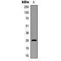 LifeSab™ RNF138 Rabbit pAb (50 µl)