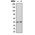 LifeSab™ MCT4 Rabbit pAb (50 µl)