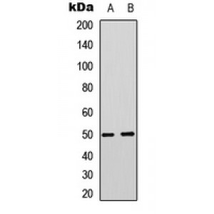 LifeSab™ MCT4 Rabbit pAb (50 µl)