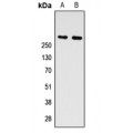 LifeSab™ ZNF462 Rabbit pAb (50 µl)