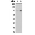 LifeSab™ ATG16L2 Rabbit pAb (50 µl)