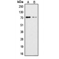 LifeSab™ Ku70 (AcK542) Rabbit pAb (50 µl)